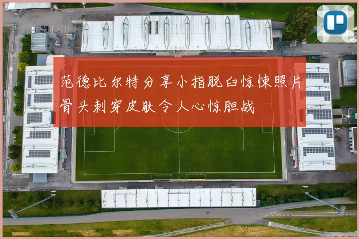 范德比尔特分享小指脱臼惊悚照片骨头刺穿皮肤令人心惊胆战